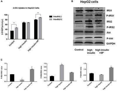 High Glucose Concentration Impairs 5-PAHSA Activity by Inhibiting AMP-Activated Protein Kinase Activation and Promoting Nuclear Factor-Kappa-B-Mediated Inflammation